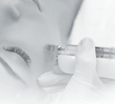 ハイコックス(水光注射)